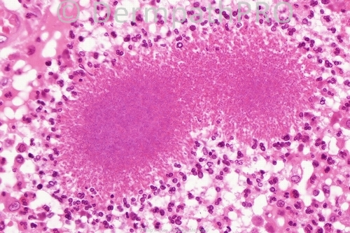 picture-1
