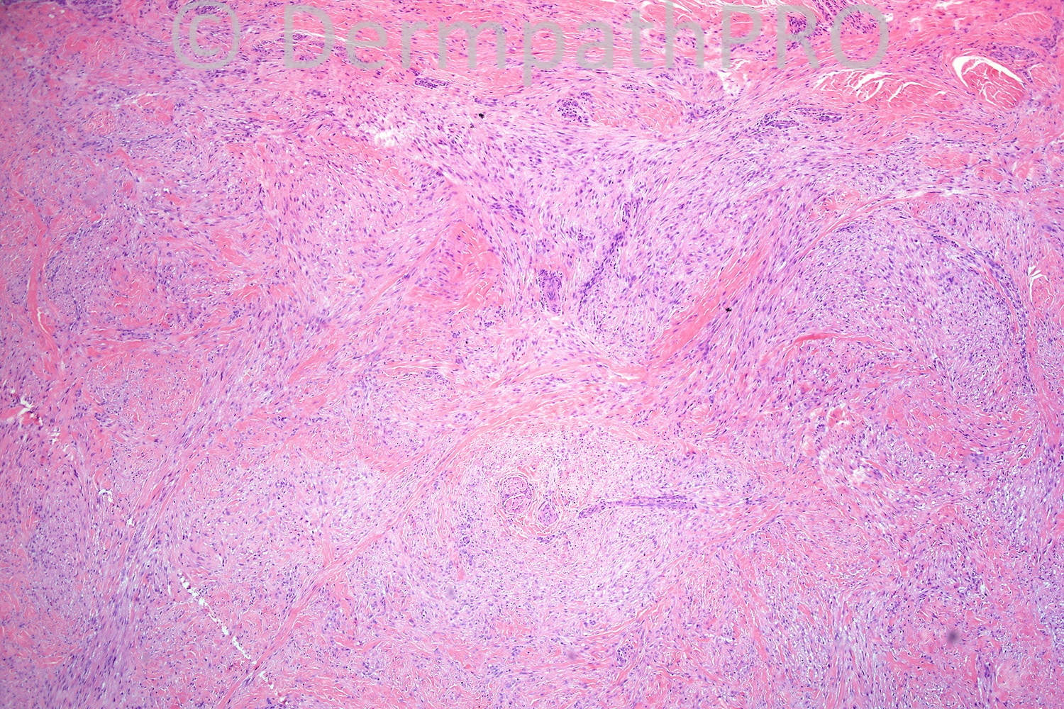 picture-1