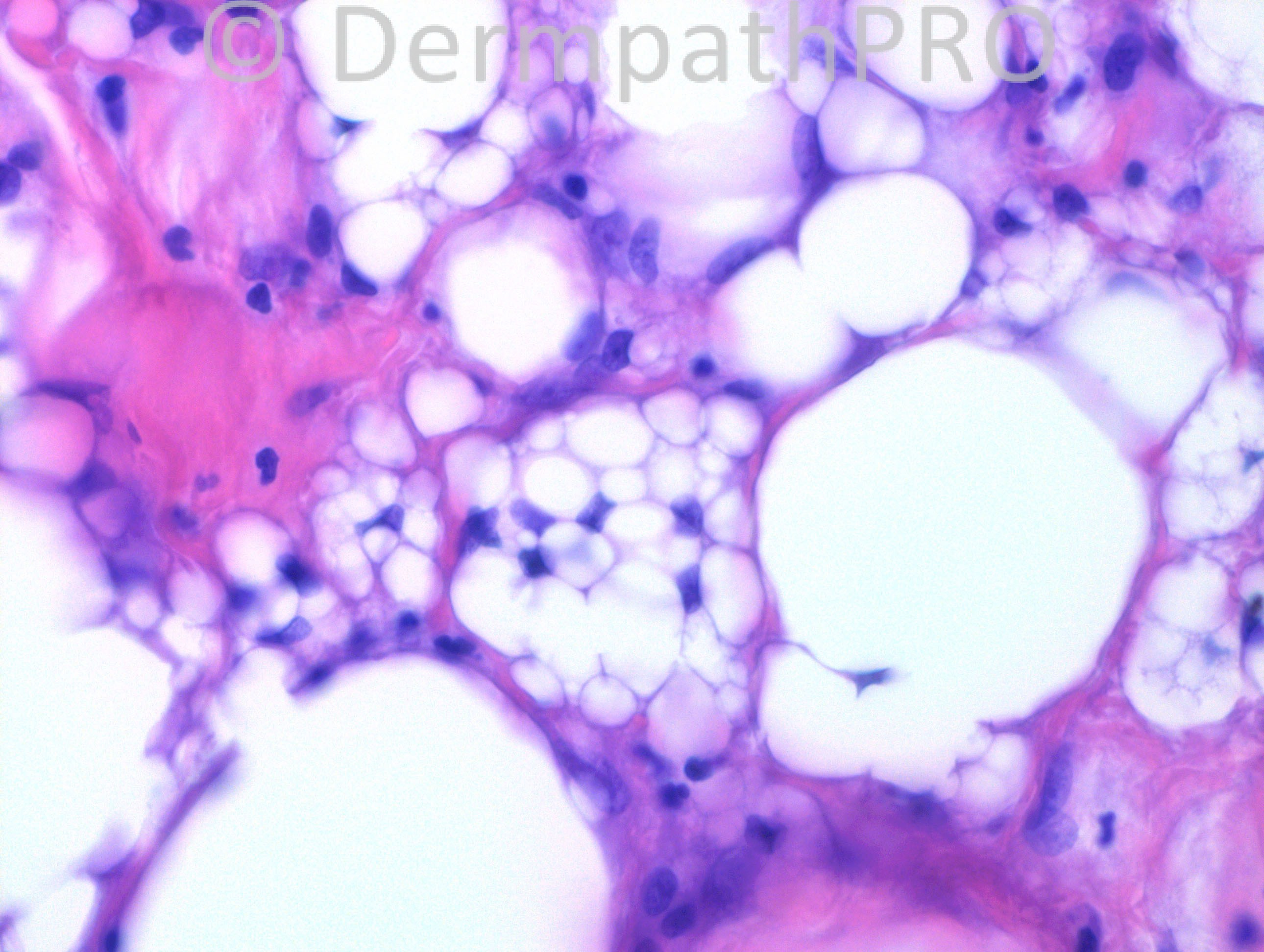 picture-3