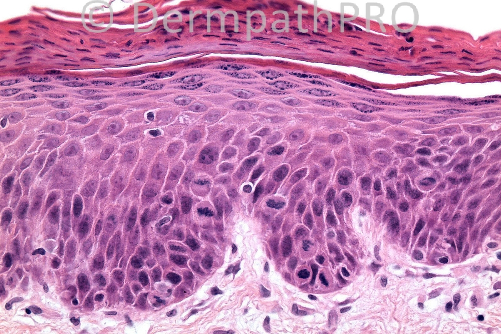 picture-4