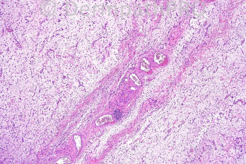 picture-1
