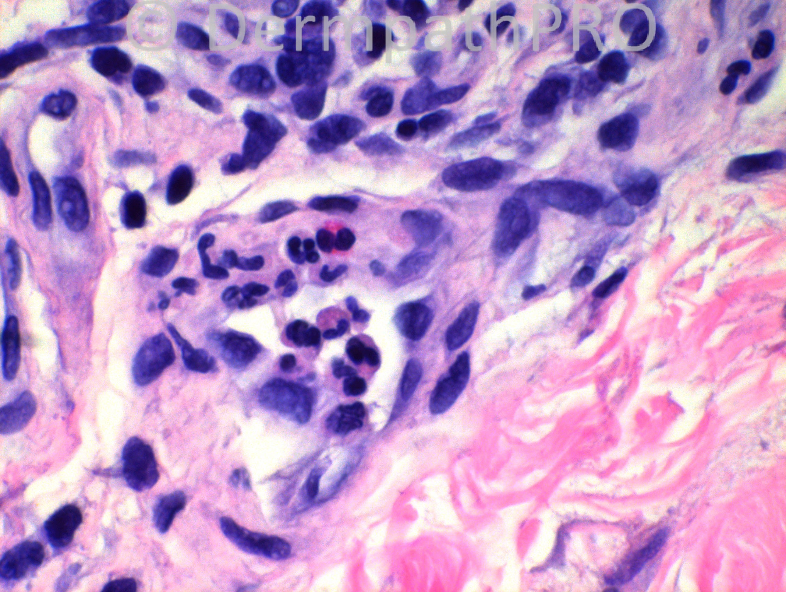 picture-4