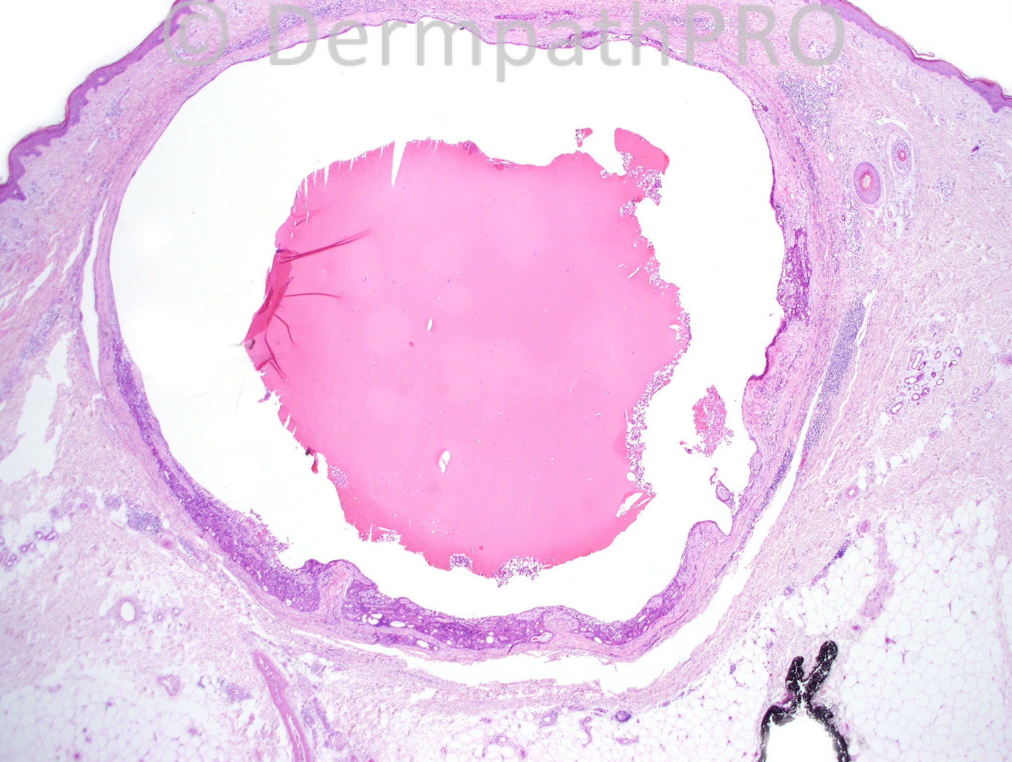 picture-1
