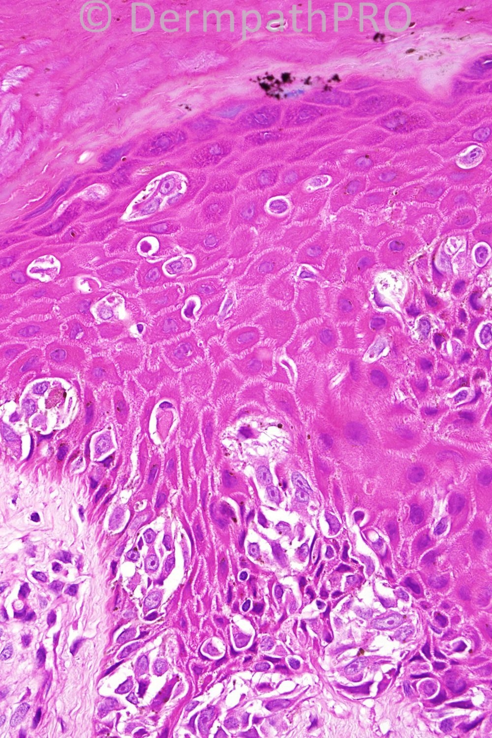 picture-4