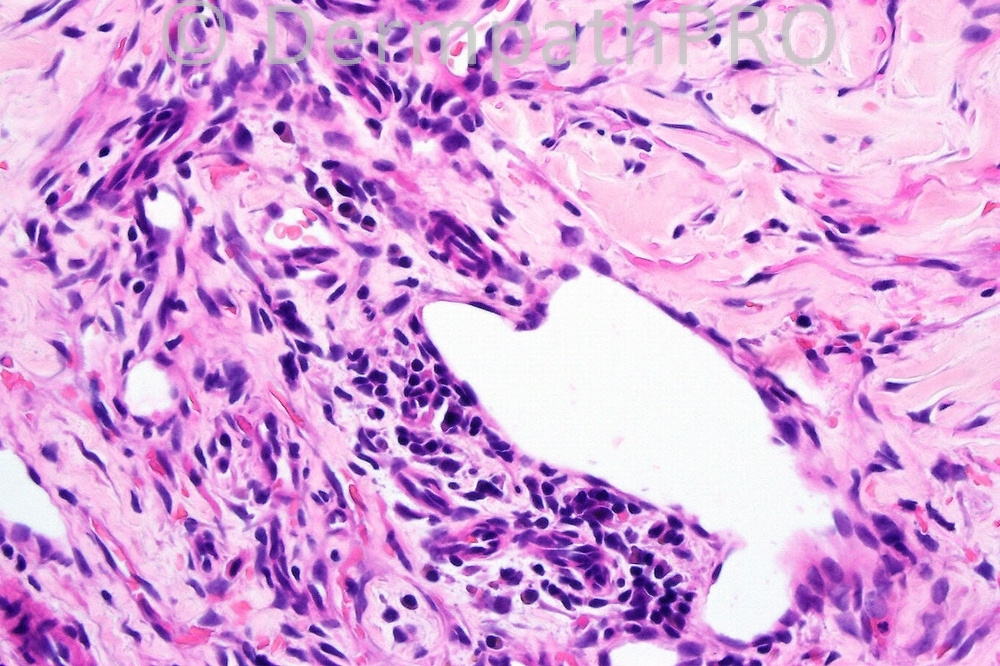 picture-4