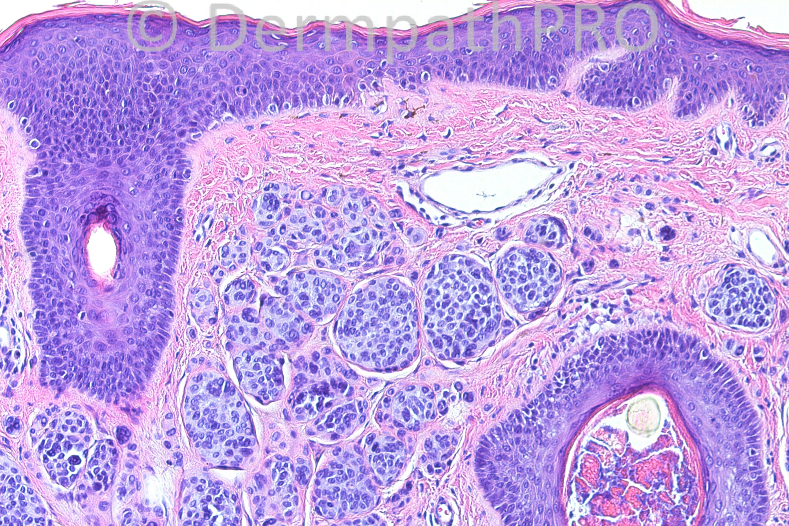 picture-1