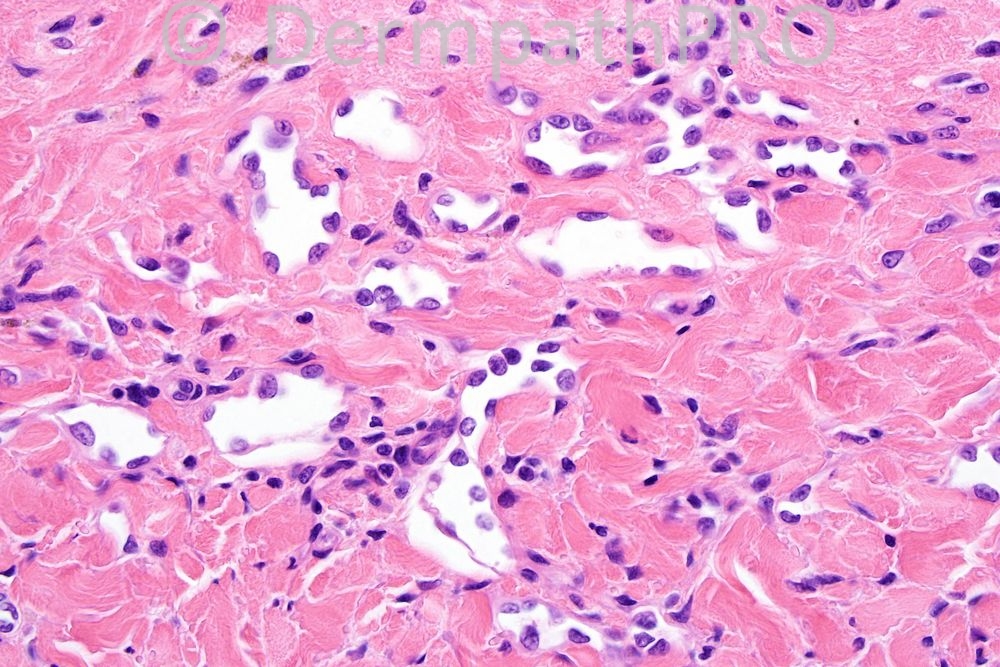 picture-4