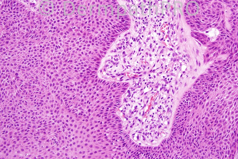 picture-2