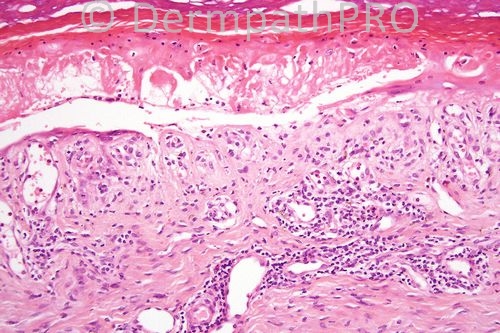 picture-1