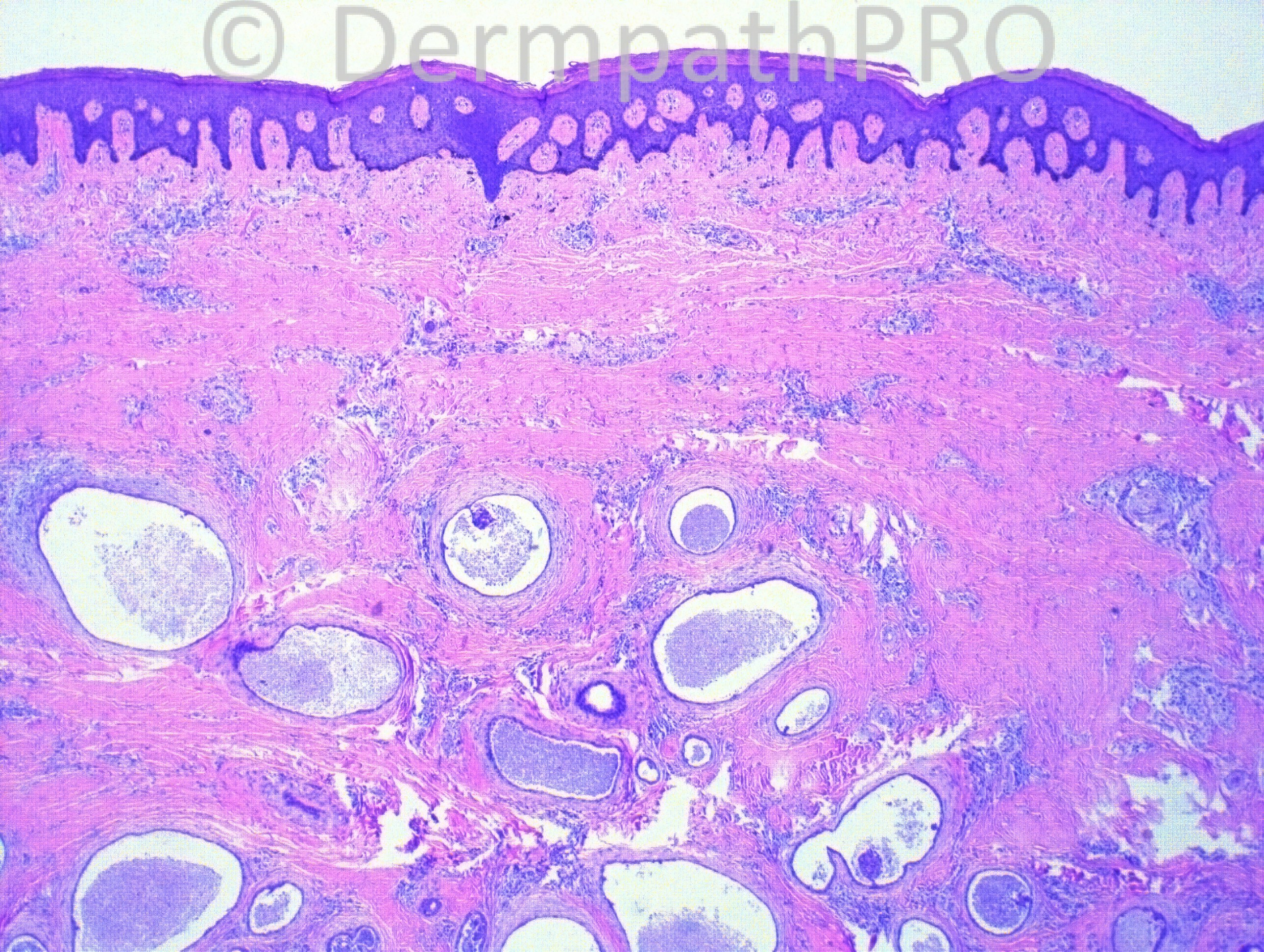 picture-1