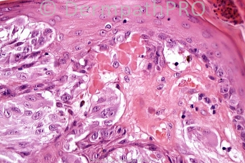 picture-1