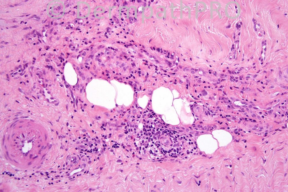 picture-3