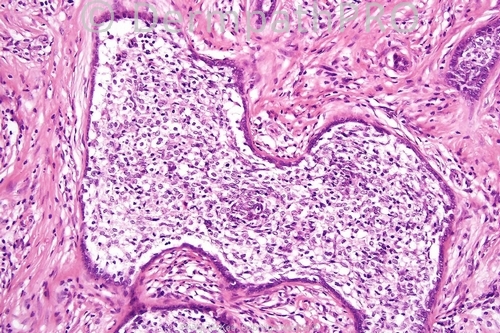picture-1
