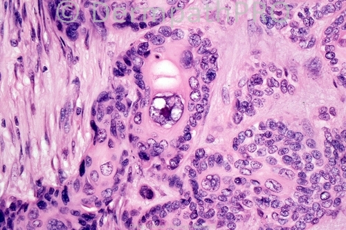picture-1