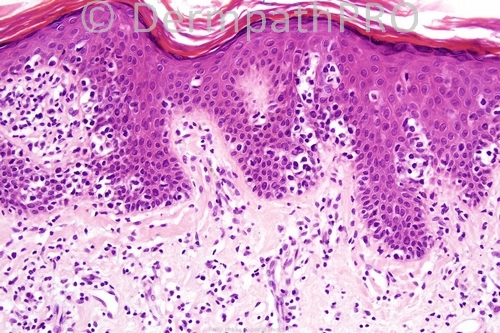 picture-1