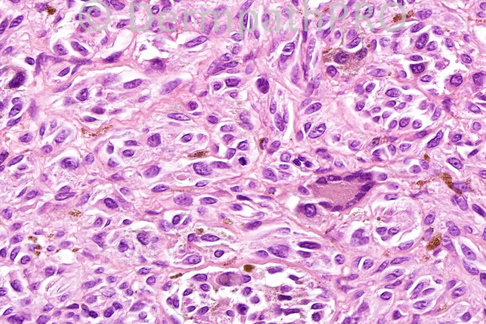 picture-4