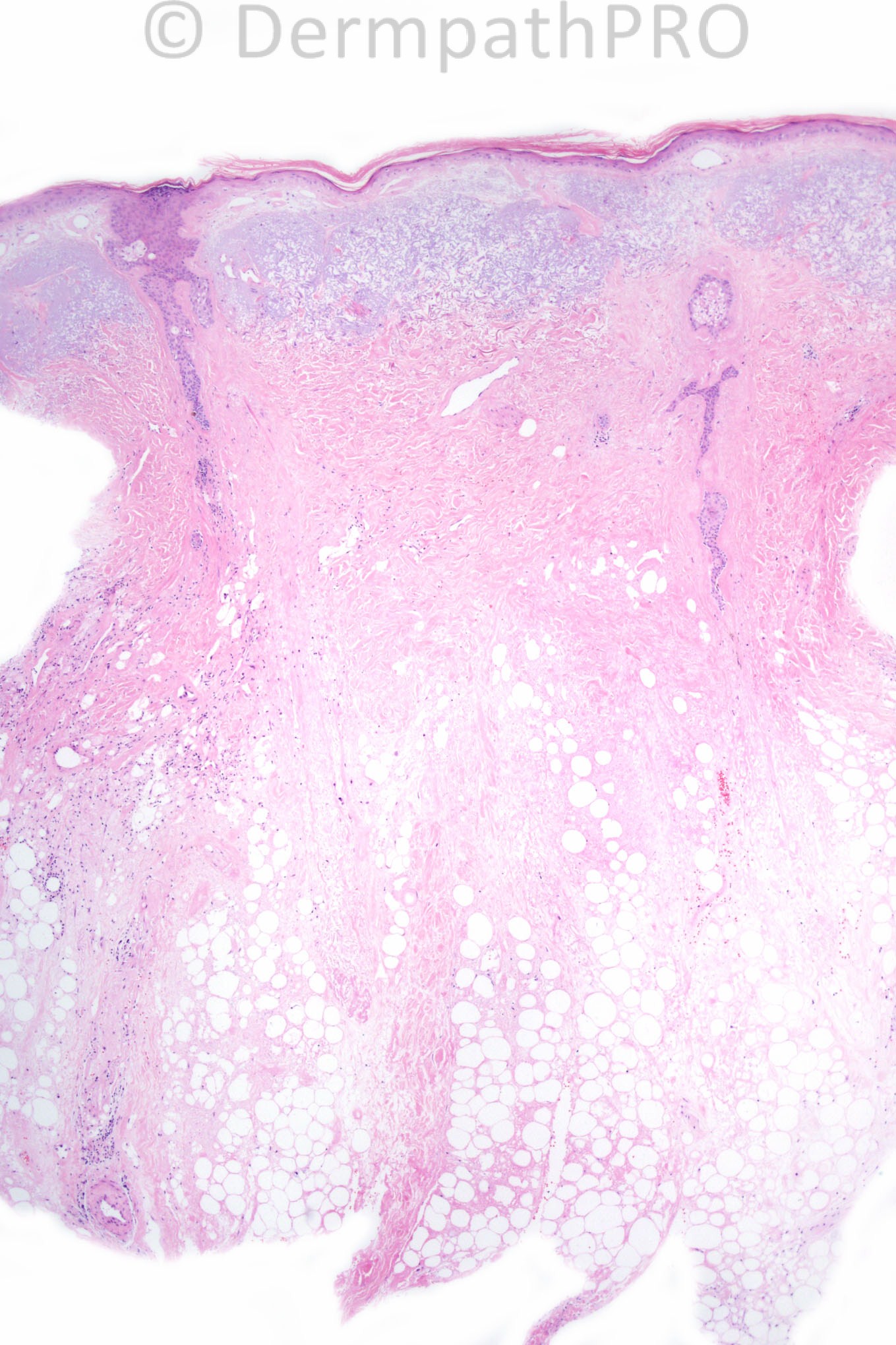 picture-1