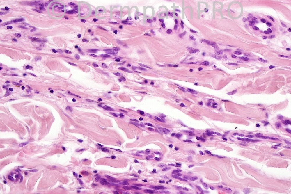 picture-3