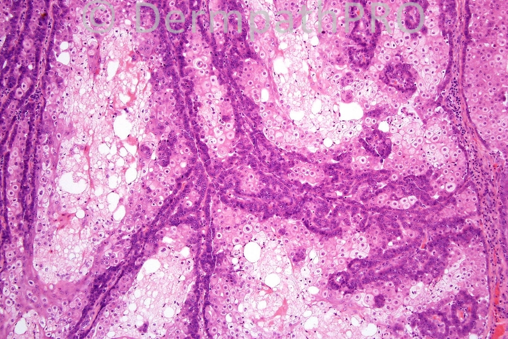 picture-2