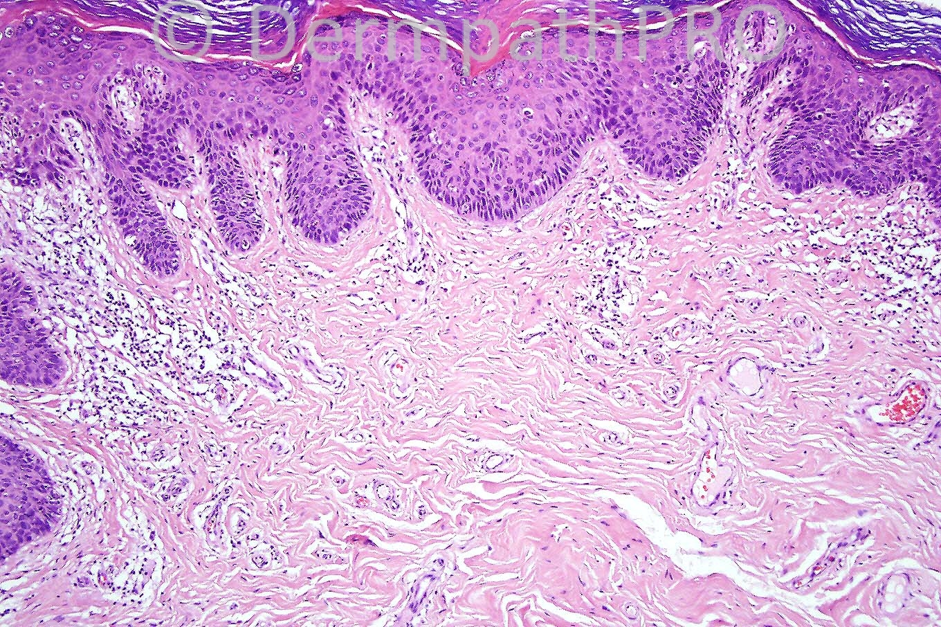 picture-2