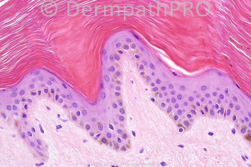 picture-1