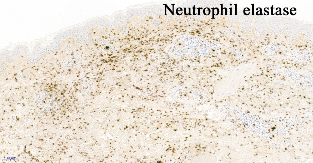01369_10.0x Neutrophil elastase labelled.jpg