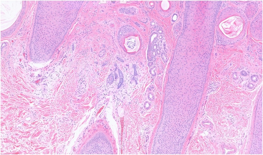picture-4