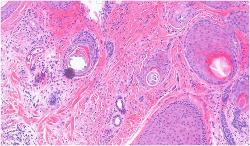 picture-5