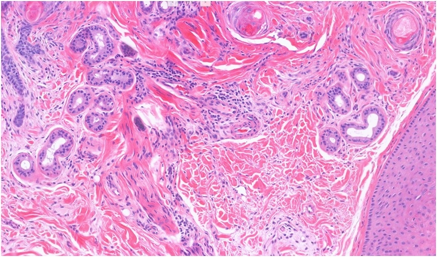picture-6